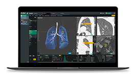 SẢN PHẨM CORELINESOFT