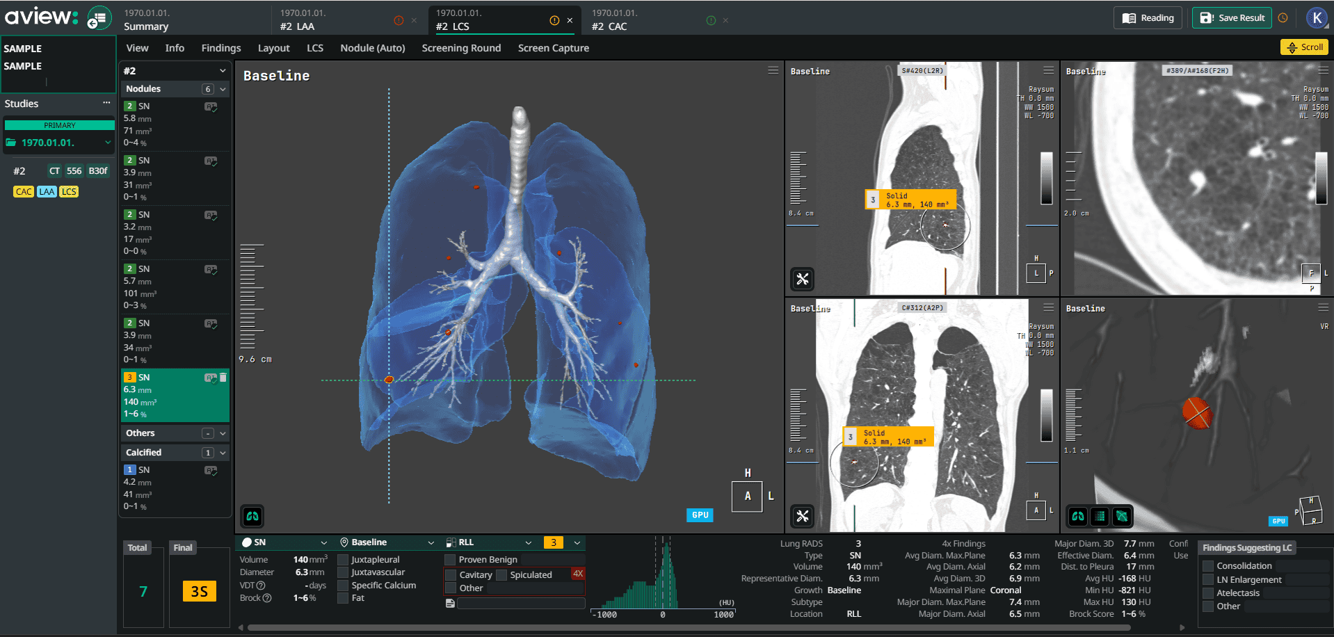 PHẦN MỀM AVIEW LUNG SCREEN