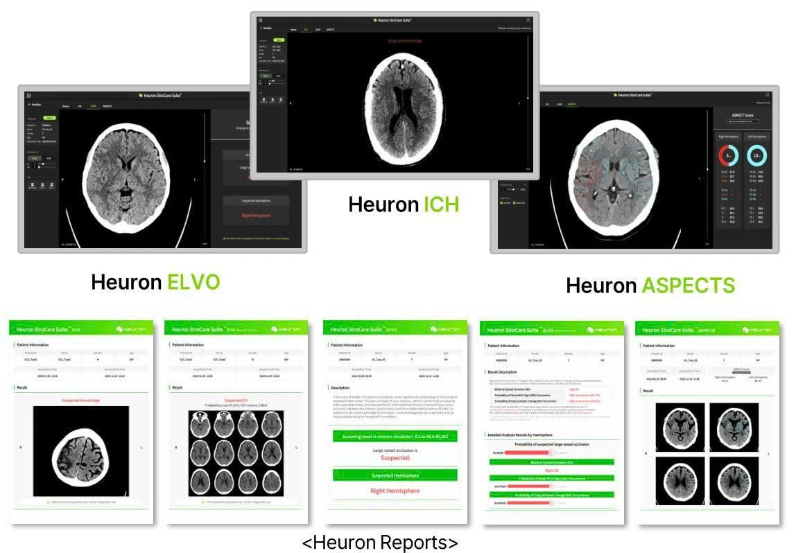PHẦN MỀM HEURON STROKE
