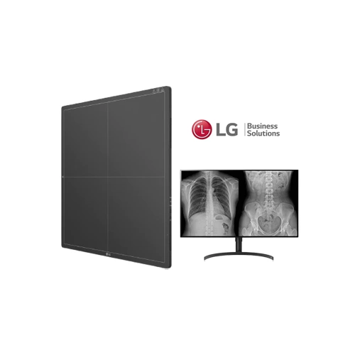 Tấm nhận kỹ thuật số LG